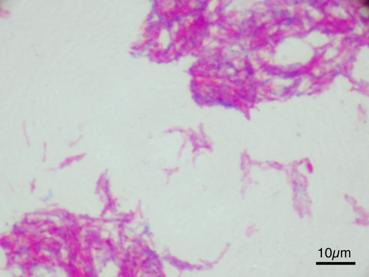 Bacillus Calmette-Guérin (BCG) — Wikimedia Commons