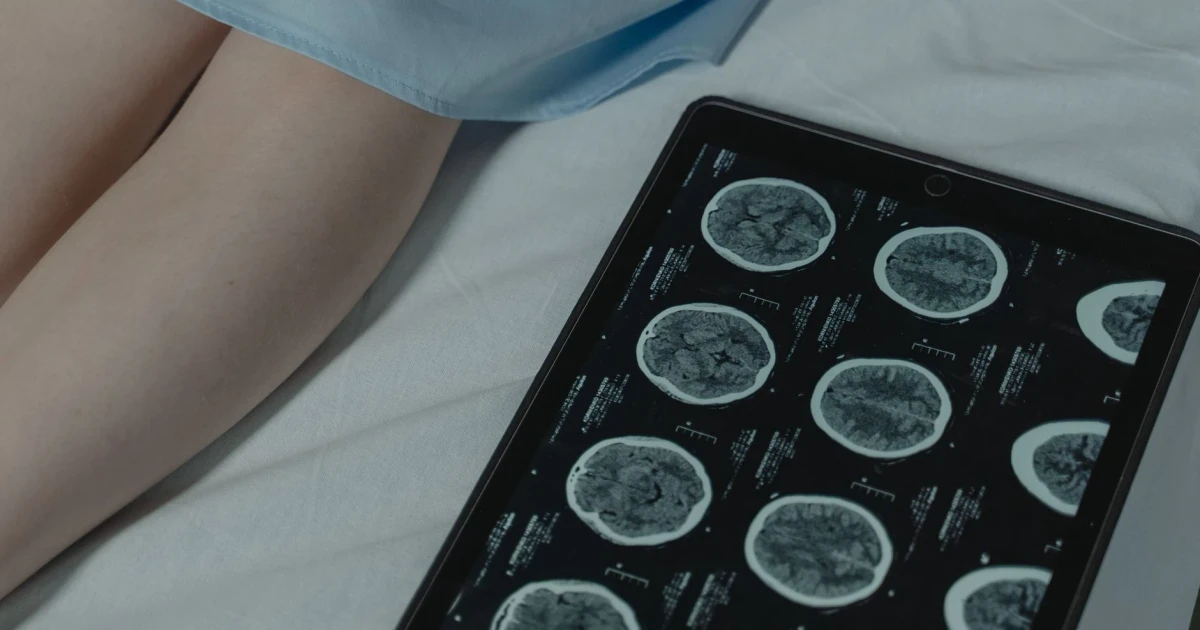 Emergency room scan reveals late-stage colon cancer, leads to liver transplant