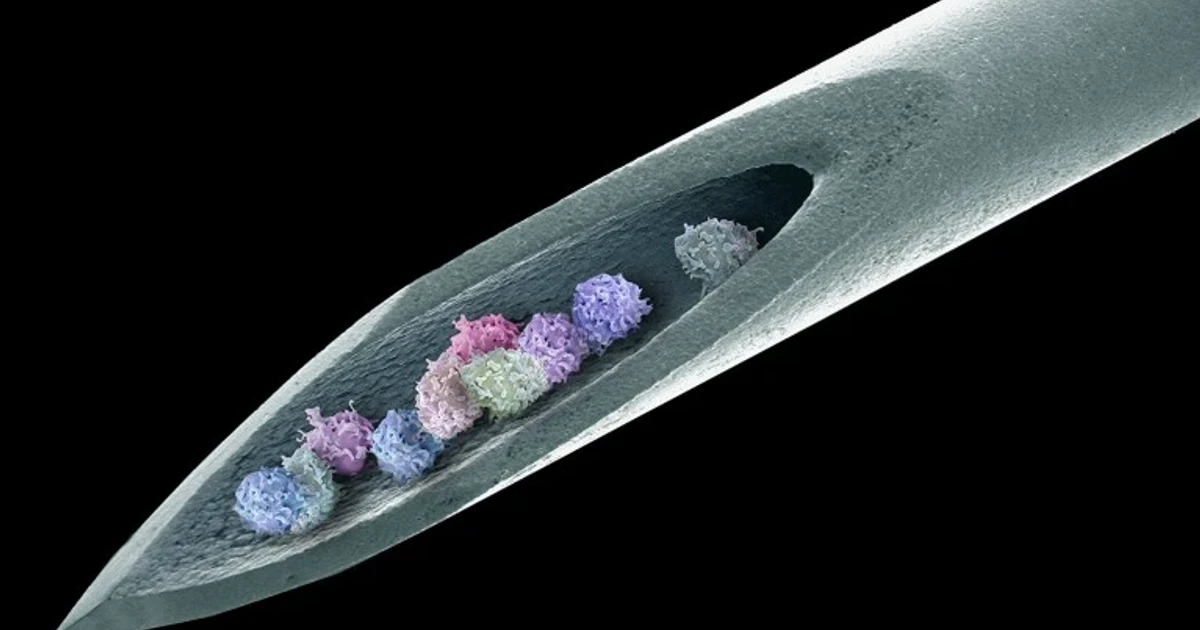 Stem-cell transplant keeps rare autoimmune disease in remission for 15 years