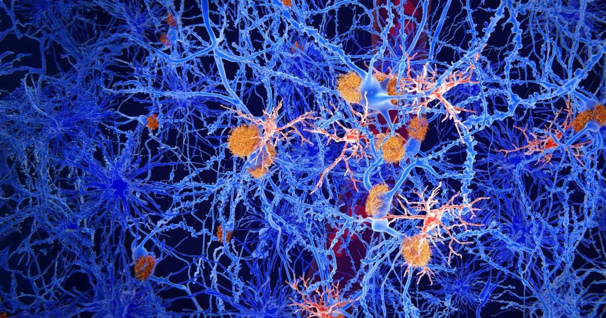 Experimental molecule reprograms brain immune cells in Alzheimer’s models