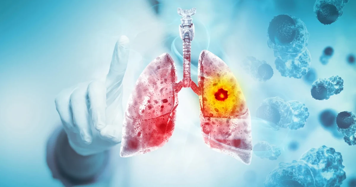 Study warns nicotine vaping may directly raise cancer risk