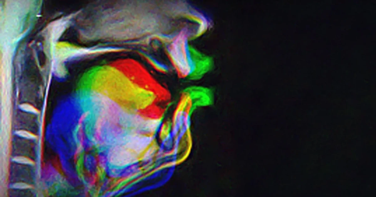 McGill study says speech learning depends on sound and sensation
