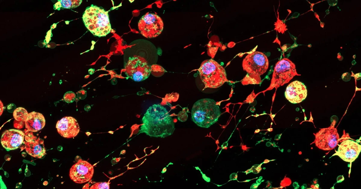 Scientists find cell death residue that may help influenza spread
