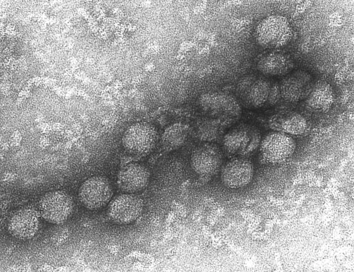 West Nile virus — Wikimedia Commons