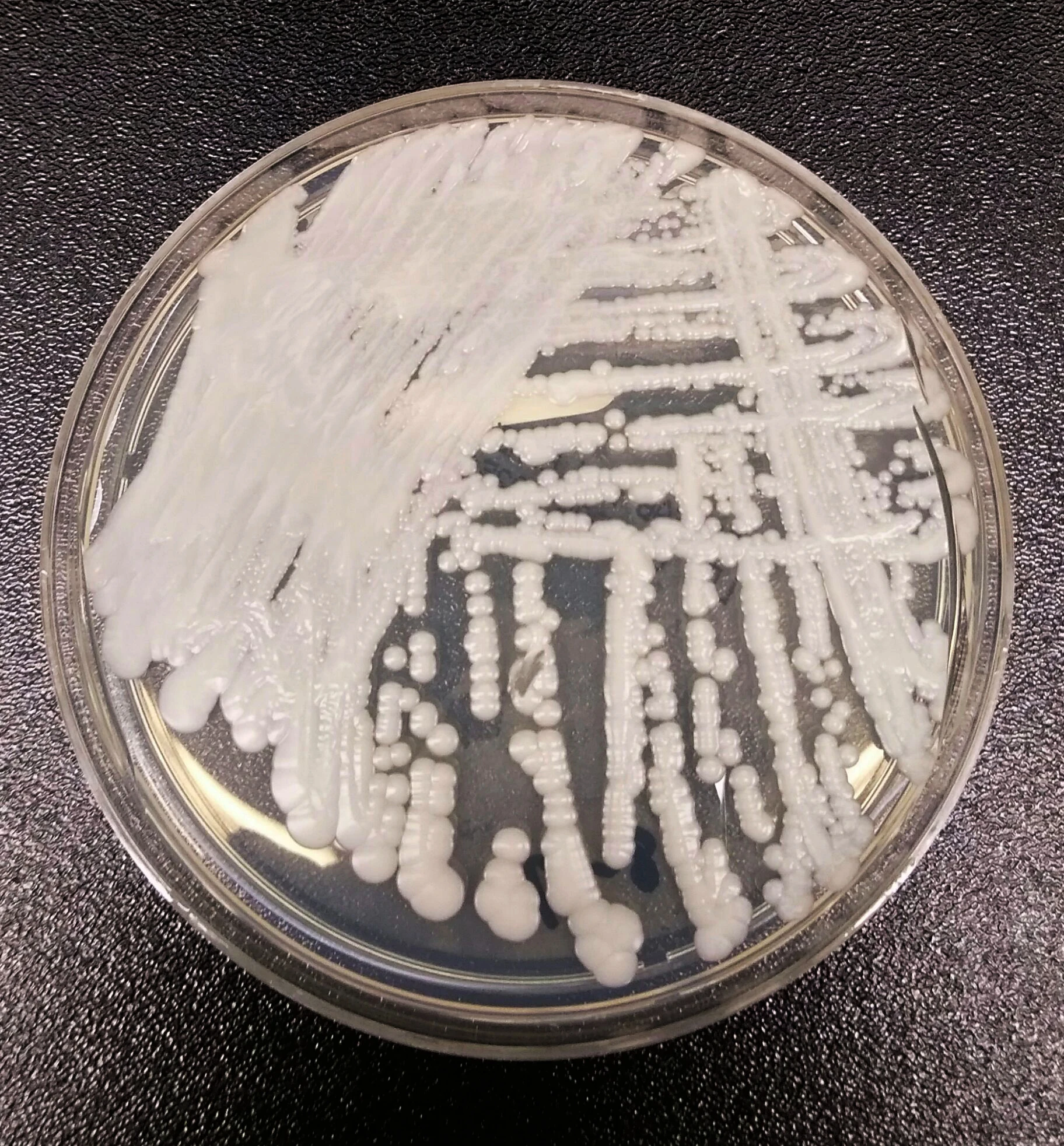 Candida auris — Wikimedia Commons