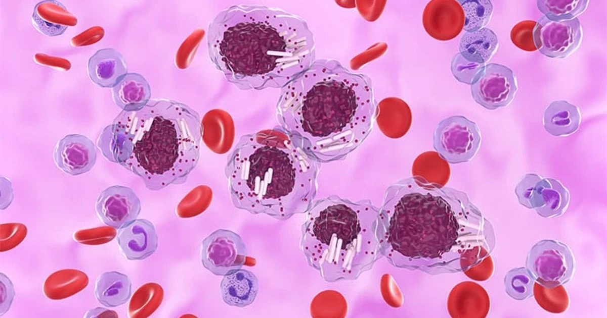 Venetoclax-obinutuzumab deepens response in untreated chronic lymphocytic leukemia