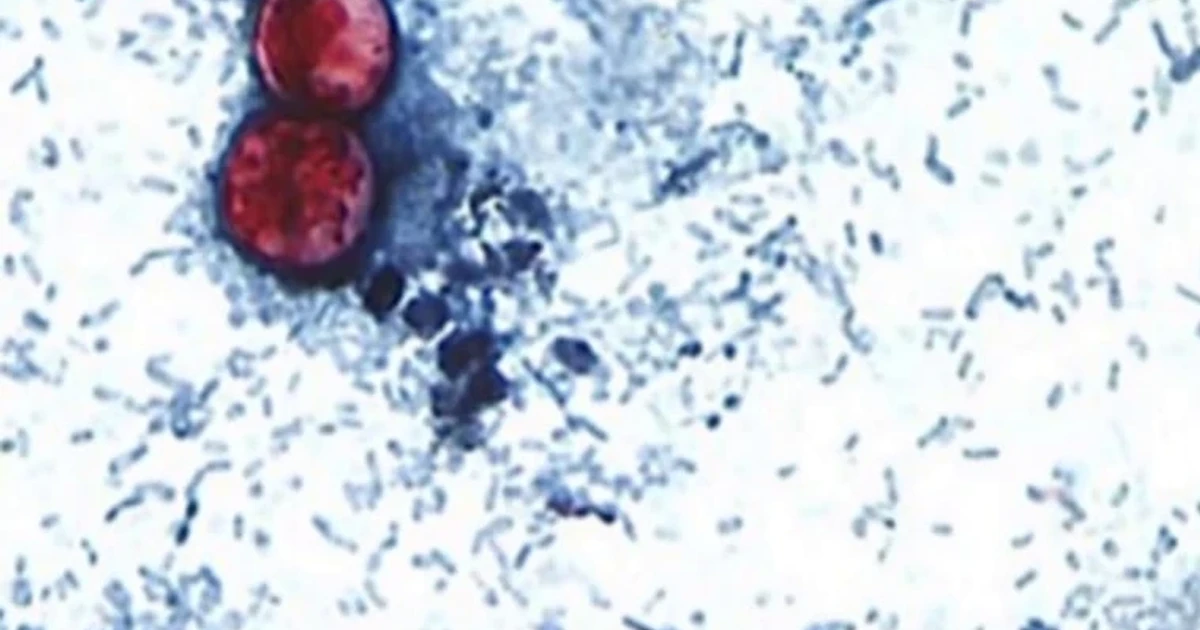 CDC links cyclosporiasis outbreaks to fresh produce, source still unknown