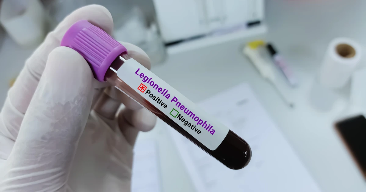New York City expands Legionnaires’ outbreak response as cases rise