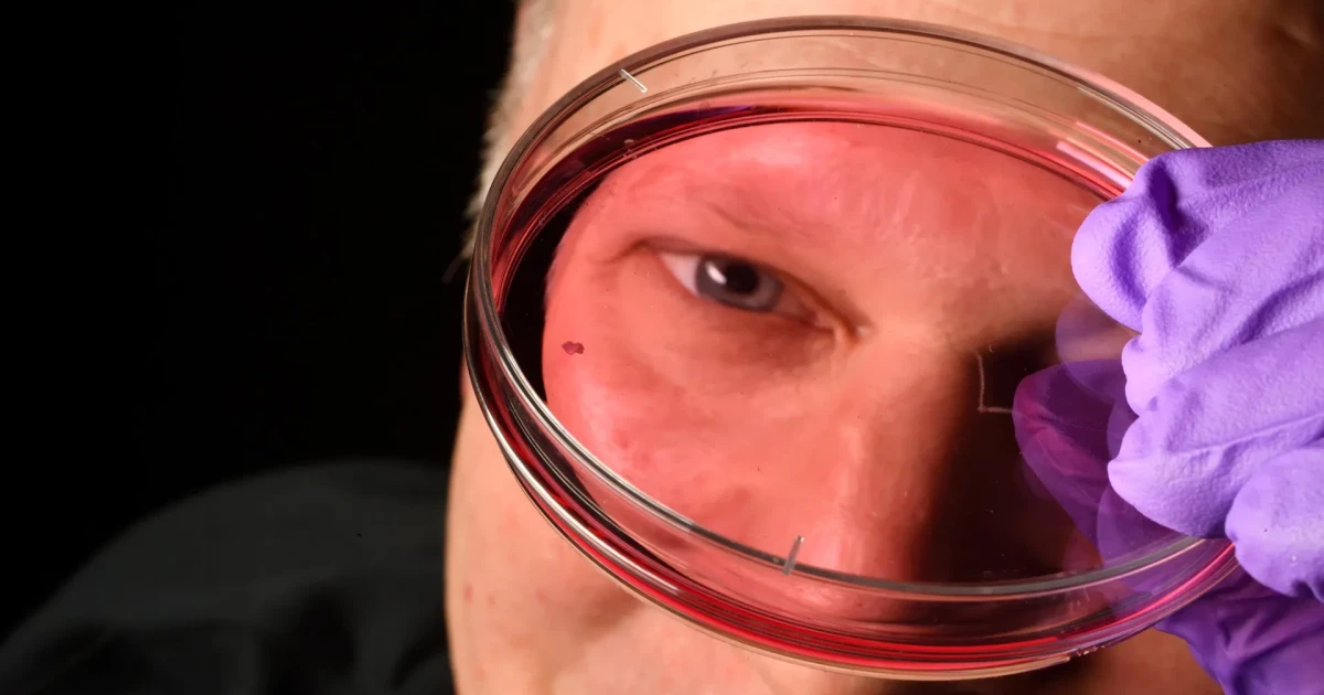 Johns Hopkins study reveals how the eye forms sharp central vision