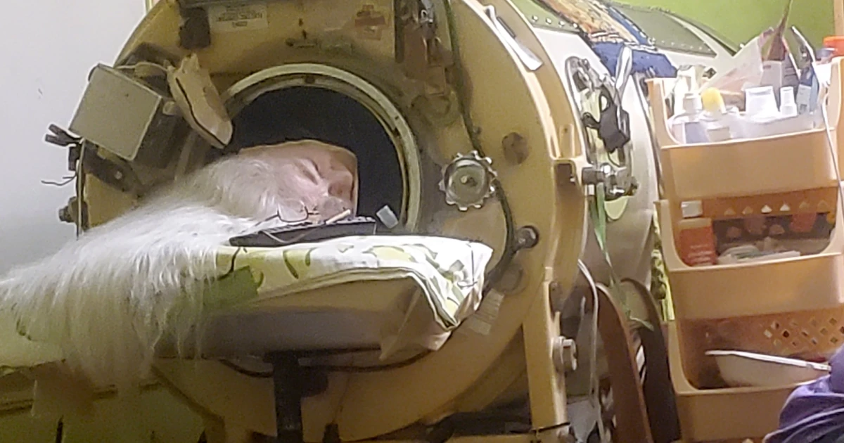 Last U.S. polio patient using iron lung dies at 78 in Oklahoma