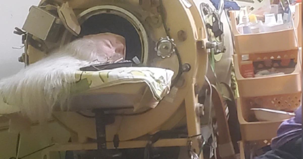 Last US iron lung polio patient Martha Lillard dies at 78