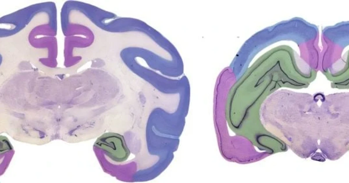 Study challenges old lizard-brain model of human evolution