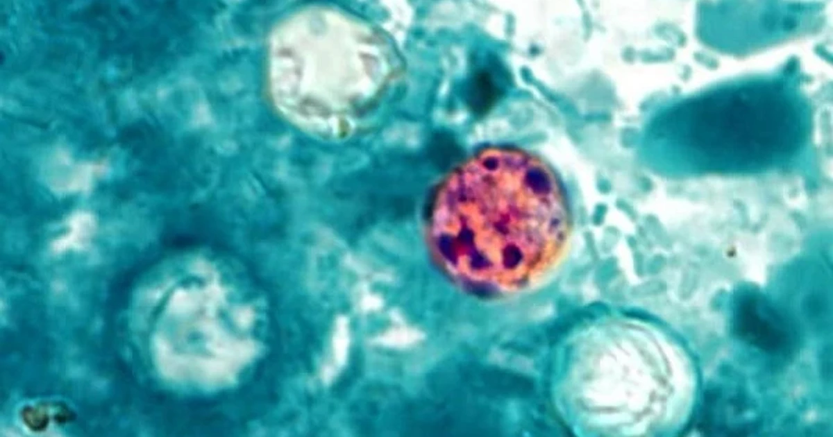 CDC investigates multistate cyclosporiasis outbreak, source still unknown