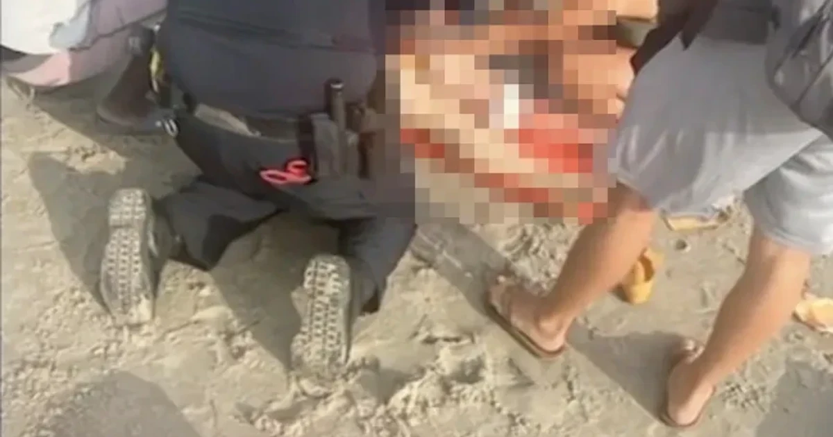 Shark sightings rise off New York and New Jersey beaches