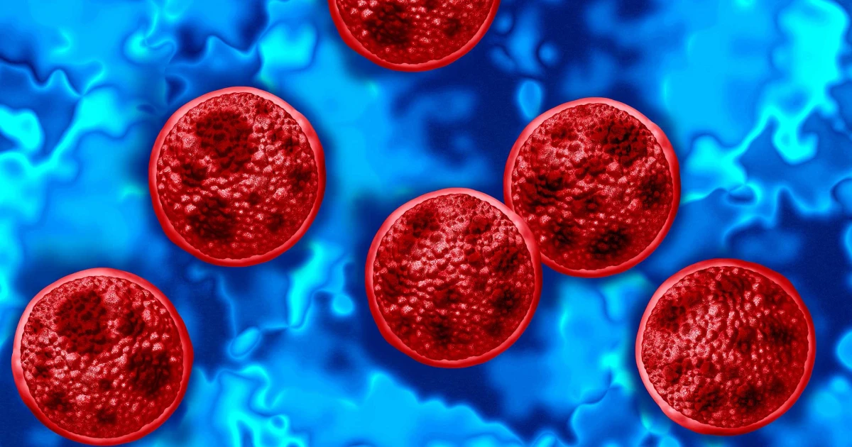 Mississippi cyclosporiasis cases rise as nationwide outbreak spreads