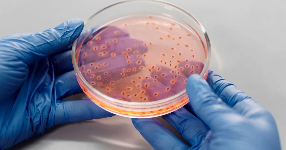 Cyclospora outbreak spreads across 34 states, sickening thousands