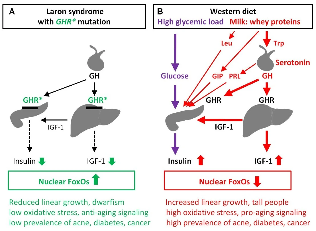 Laron syndrome — Wikimedia Commons