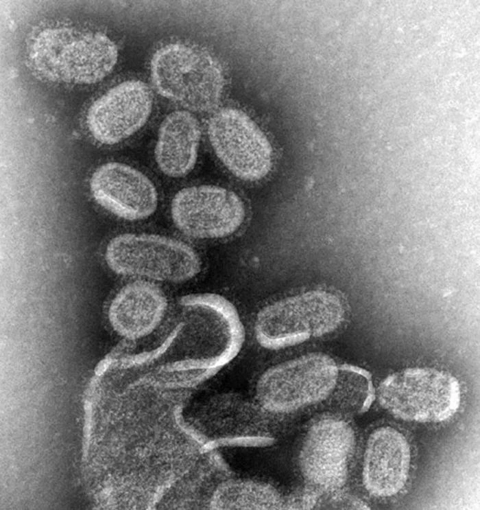 1918 influenza pandemic — Wikimedia Commons