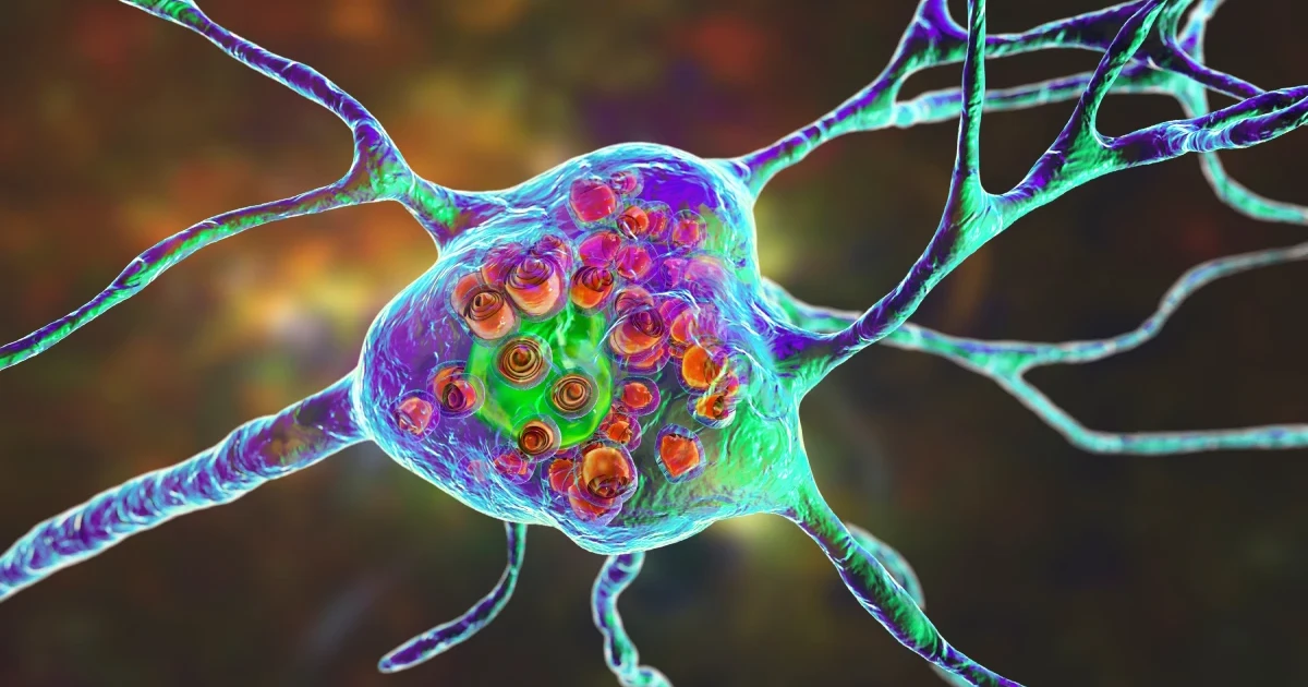 Nonprofit center aims to speed gene therapy for rare diseases