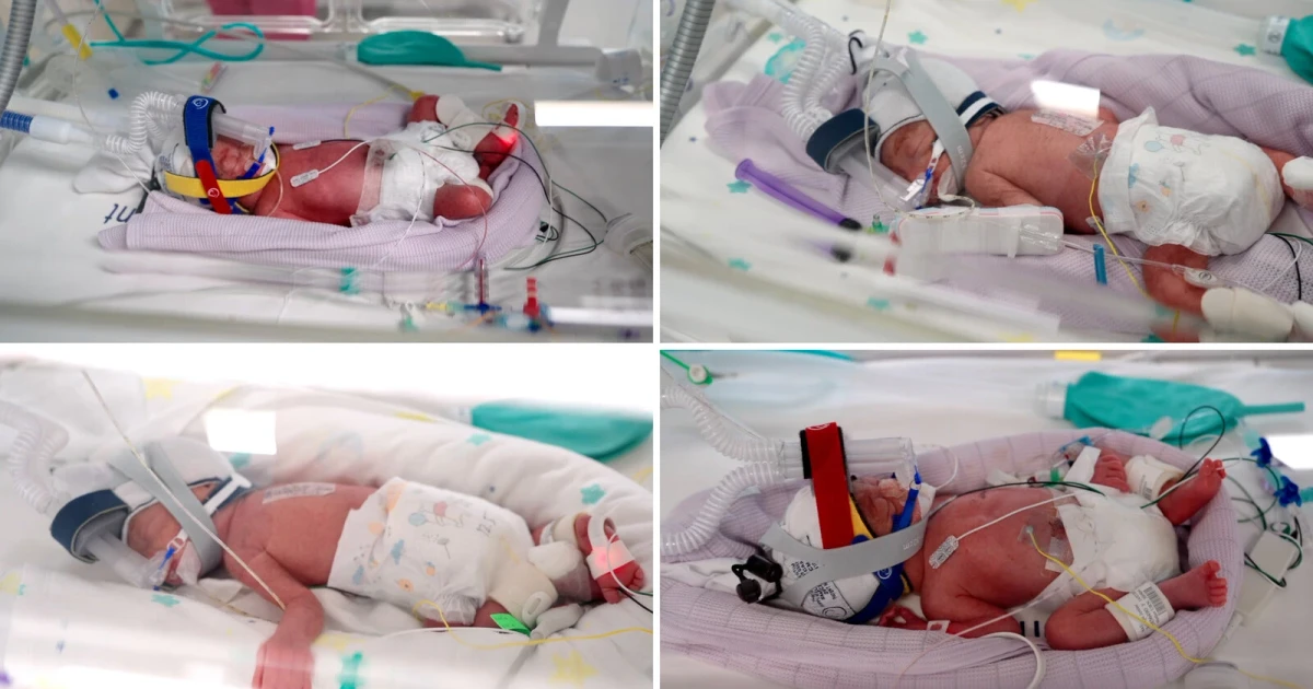 Australia welcomes rare naturally conceived quadruplets in Brisbane hospital