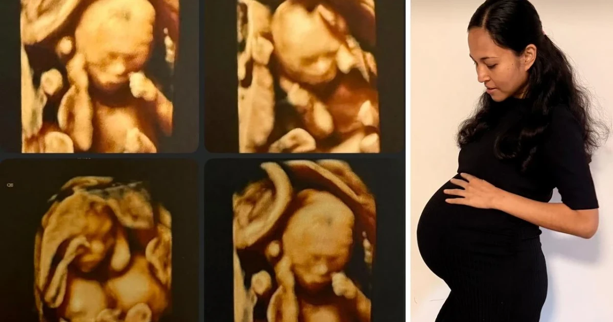Australian woman gives birth to identical quadruplet girls in Brisbane