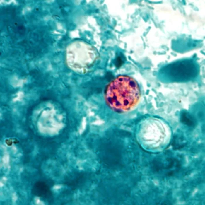 cyclospora — Wikimedia Commons