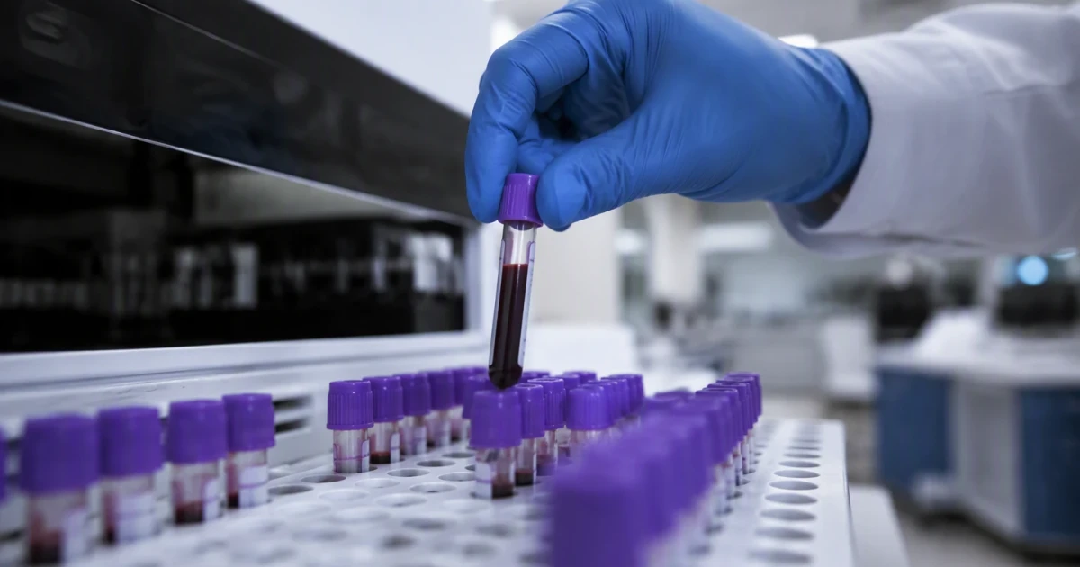 FDA schedules review of Grail's Galleri blood cancer test